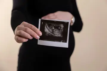 孕婦手持胎兒超音波影像，呈現孕期產檢與羊水評估主題